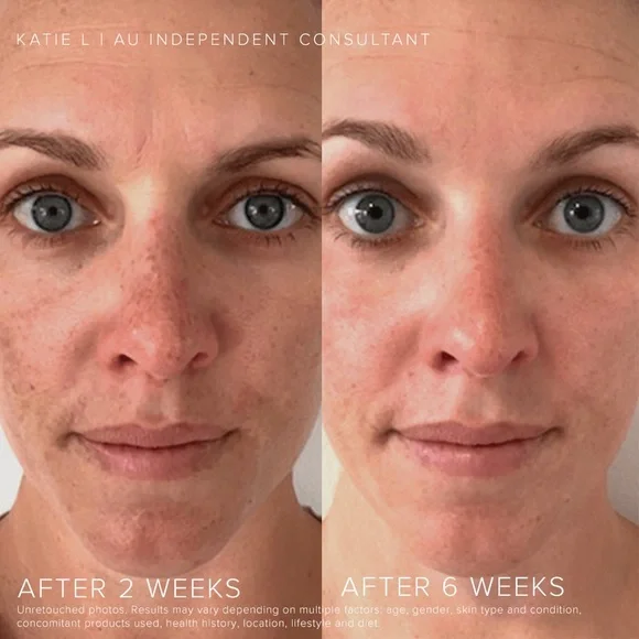 COPY - Rodan&Fields Reverse Regimen - Picture 3 of 4